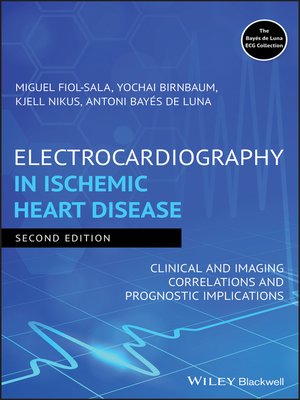 cover image of Electrocardiography in Ischemic Heart Disease